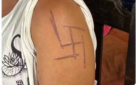 'Tenho que trocar a minha pele', diz mulher trans marcada com símbolo nazista durante tortura em MS